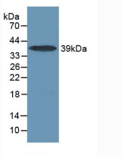 Polyclonal Antibody to Interleukin 17 Receptor A (IL17RA)