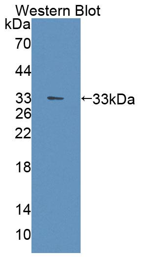 Polyclonal Antibody to Phosphoglycerate Mutase 2, Muscle (PGAM2)