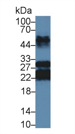 Polyclonal Antibody to Major Basic Protein (MBP)