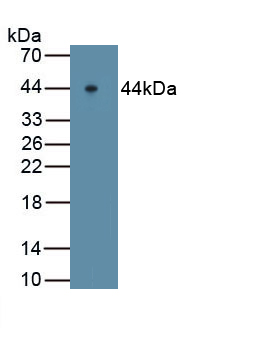 Polyclonal Antibody to Major Basic Protein (MBP)