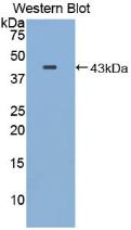 Polyclonal Antibody to Major Basic Protein (MBP)