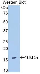 Polyclonal Antibody to Interleukin 18 Receptor 1 (IL18R1)