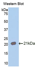 Polyclonal Antibody to Interleukin 18 Receptor 1 (IL18R1)