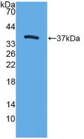 Polyclonal Antibody to Trefoil Factor 3 (TFF3)