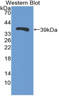 Polyclonal Antibody to Trefoil Factor 3 (TFF3)