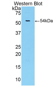 Polyclonal Antibody to Trefoil Factor 3 (TFF3)