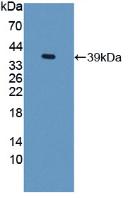 Polyclonal Antibody to Trefoil Factor 3 (TFF3)