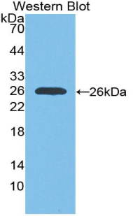 Polyclonal Antibody to Insulin Like Growth Factor 1 Receptor (IGF1R)