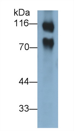 Polyclonal Antibody to Cluster Of Differentiation 146 (CD146)