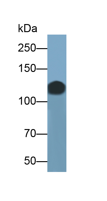 Polyclonal Antibody to Cluster Of Differentiation 146 (CD146)