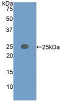 Polyclonal Antibody to Insulin Like Growth Factor Binding Protein 7 (IGFBP7)