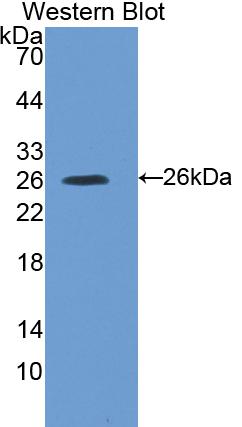 Polyclonal Antibody to Suppressors Of Cytokine Signaling 3 (SOCS3)