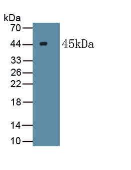 PAB692Hu01.jpg