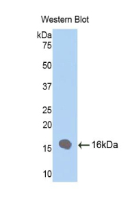 Polyclonal Antibody to Fatty Acid Binding Protein 4 (FABP4)