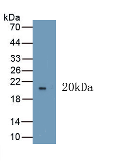 Polyclonal Antibody to Vascular Endothelial Growth Factor 165 (VEGF165)