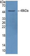 Polyclonal Antibody to Alpha-1-Antitrypsin (a1AT)