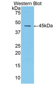 Polyclonal Antibody to Alpha-1-Antitrypsin (a1AT)