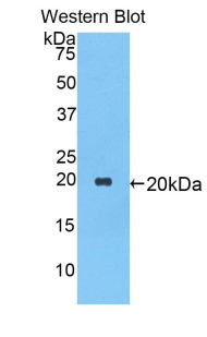 Polyclonal Antibody to Alpha-1-Antitrypsin (a1AT)