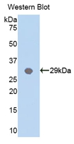 Polyclonal Antibody to Myeloid Differentiation Factor 88 (MyD88)