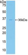 Polyclonal Antibody to Farnesyl Diphosphate Farnesyltransferase 1 (FDFT1)