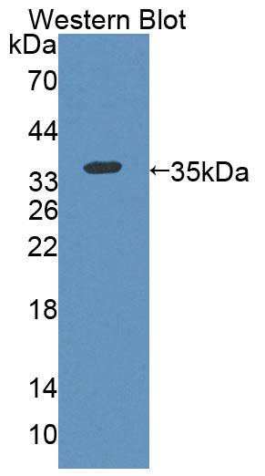 Polyclonal Antibody to Kell Protein (KEL)