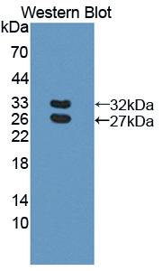 Polyclonal Antibody to Basal Cell Adhesion Molecule (BCAM)