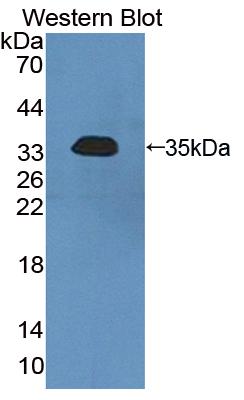 Polyclonal Antibody to Serum/Glucocorticoid Regulated Kinase 2 (SGK2)