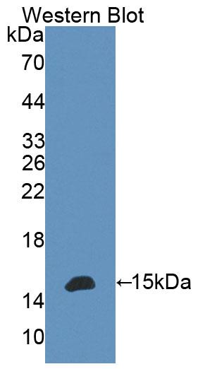 Polyclonal Antibody to B And T-Lymphocyte Attenuator (BTLA)