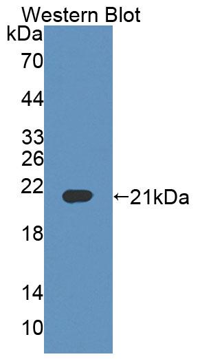 Polyclonal Antibody to B And T-Lymphocyte Attenuator (BTLA)