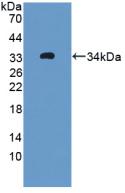 Polyclonal Antibody to Oncoprotein Induced Transcript 3 (OIT3)