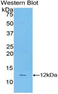 Polyclonal Antibody to Caspase 4 (CASP4)