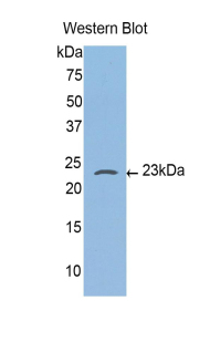 Polyclonal Antibody to Caspase 4 (CASP4)