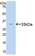 Polyclonal Antibody to Signal Transducer And Activator Of Transcription 6 (STAT6)