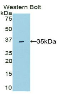Polyclonal Antibody to Signal Transducer And Activator Of Transcription 6 (STAT6)