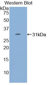 Polyclonal Antibody to Signal Transducer And Activator Of Transcription 4 (STAT4)