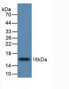 Polyclonal Antibody to UDP Glucose Ceramide Glucosyltransferase (UGCG)