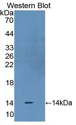 Polyclonal Antibody to Signal Transducer And Activator Of Transcription 3 (STAT3)