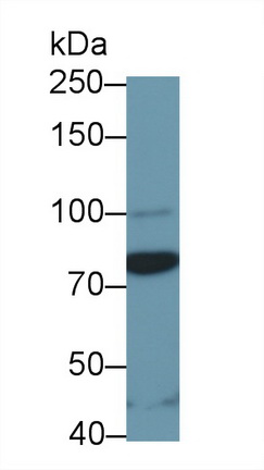 Polyclonal Antibody to Signal Transducer And Activator Of Transcription 3 (STAT3)