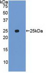 Polyclonal Antibody to Ubiquitin D (UBD)