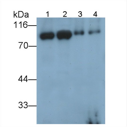 Polyclonal Antibody to Phosphofructokinase, Platelet (PFKP)