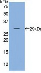 Polyclonal Antibody to Hexokinase 3, White Cell (HK3)