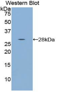 Polyclonal Antibody to Tryptophanyl tRNA Synthetase (WARS)