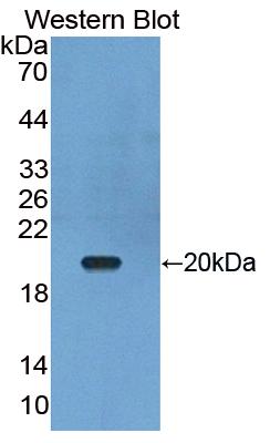 Polyclonal Antibody to Tumor Necrosis Factor Ligand Superfamily, Member 13 (TNFSF13)