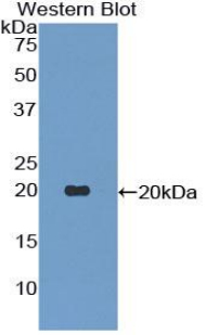 Polyclonal Antibody to Tumor Necrosis Factor Ligand Superfamily, Member 13 (TNFSF13)