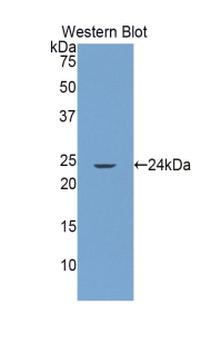 Polyclonal Antibody to Glutamate Receptor Interacting Protein 1 (GRIP1)