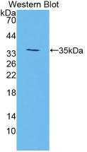 Polyclonal Antibody to Transglutaminase 3, Epidermal (TGM3)
