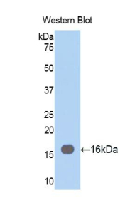 Polyclonal Antibody to Fascin (FSCN)