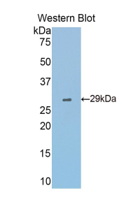 Polyclonal Antibody to Fascin (FSCN)