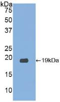 Polyclonal Antibody to Ribonuclease A3 (RNASE3)