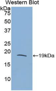 Polyclonal Antibody to Ribonuclease A3 (RNASE3)